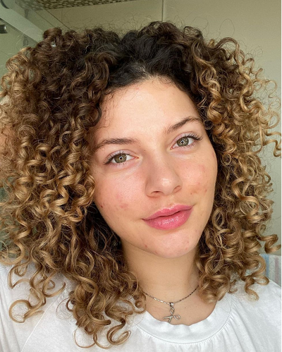 How To Treat Hormonal Acne